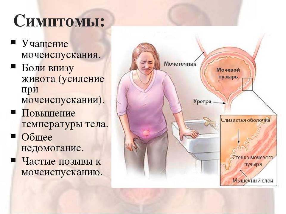 Увеличенные миндалины без температуры