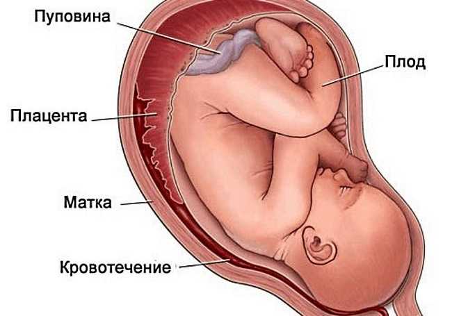 Выделения во время беременности. на что стоит обращать внимание?