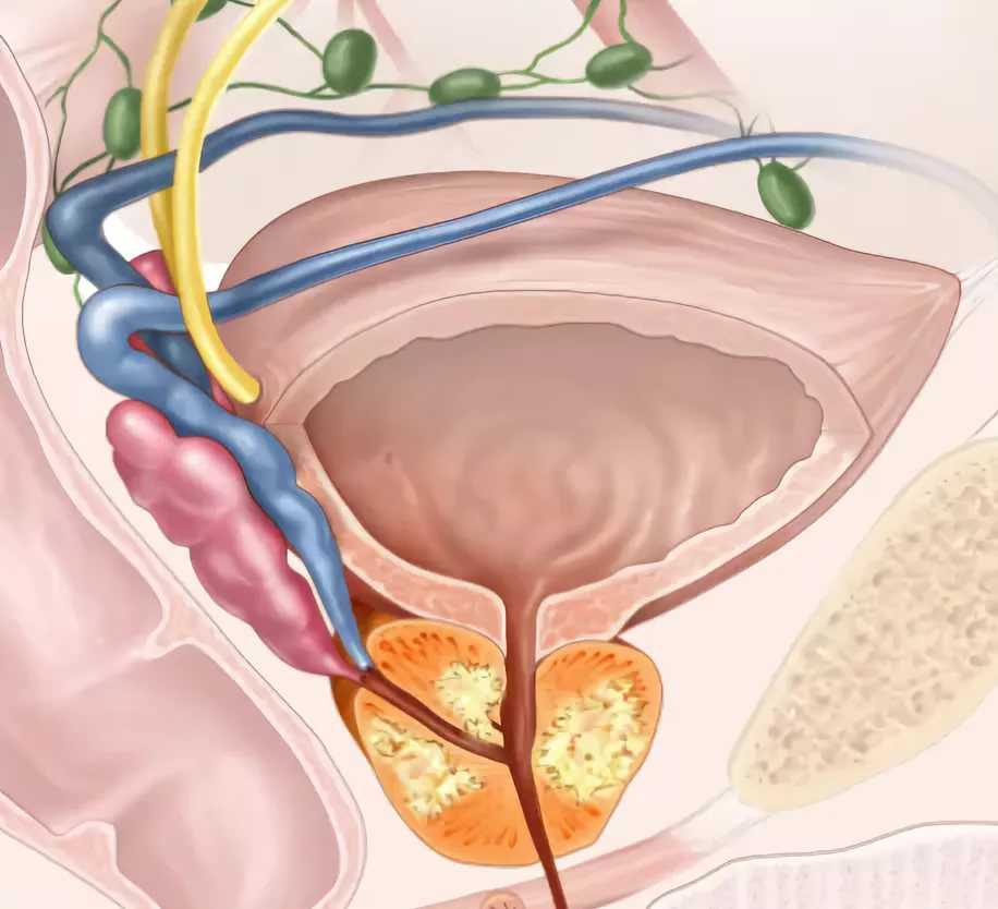 Простата рак симптомы лечение