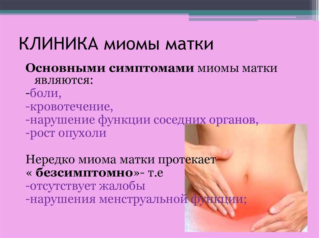 Endometriosis mioma