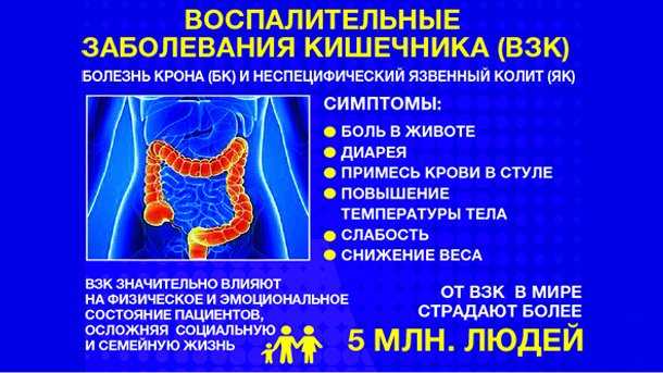 Расстройство пищеварения желудочно-кишечного тракта: диспепсия - лечебно-диагностический центр нейрон (таганрог)