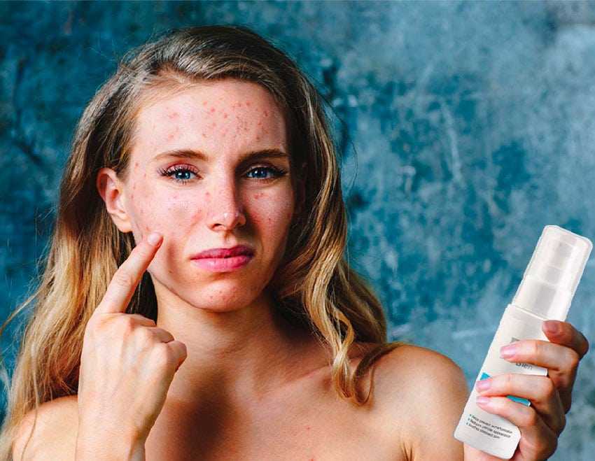 Аллергия на косметику: какие компоненты опасны для кожи? - форма