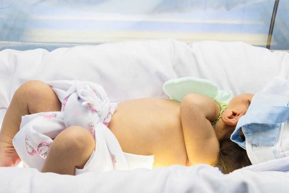 Е. комаровский: желтушка у новорожденных: когда должна пройти желтуха, лечение в домашних условиях