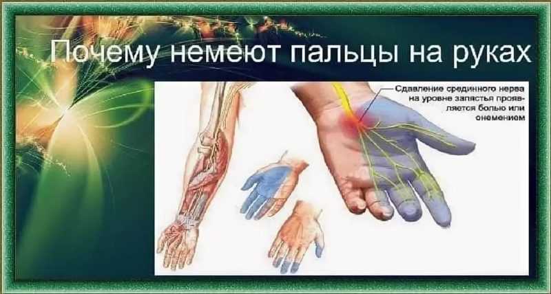 Немеют пальцы рук какой врач. МНЕМТ пальцы на левой руке. Онемение пальцев левой руки. Немеют пальцы на руках причины.