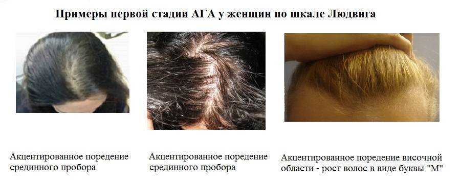 Подсолнечное масло для волос - можно ли использовать для масок