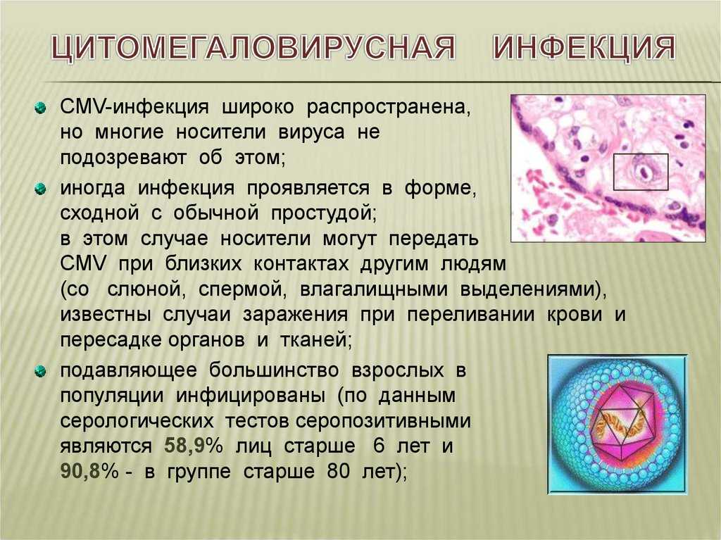 Цитомегаловирус — симптомы, лечение, профилактика | «восьмая клиника»