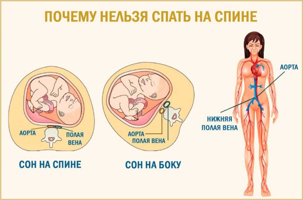 Какими позами можно заниматься сексом при беременности. Беременным нельзя спать на спине. Как спать беременным. Почему беременным нельзя спать на спине. Почему беременной нельзя спать на спине.