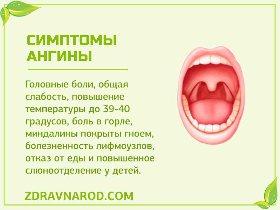 Болит горло без температуры это коронавирус или орви: может быть или нет, заложен нос, болит голова, чихание, сопутствующие симптомы