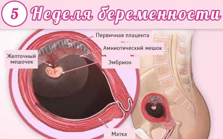 Болит живот при беременности. причины и последствия болей в животе у беременных