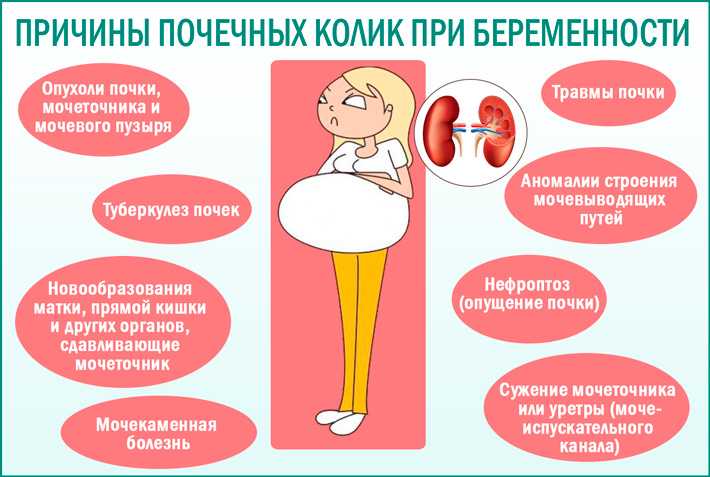 Пиелонефрит и беременность. причины развития пиелонефрита. симптомы пиелонефрита. лечение пиелонефрита.