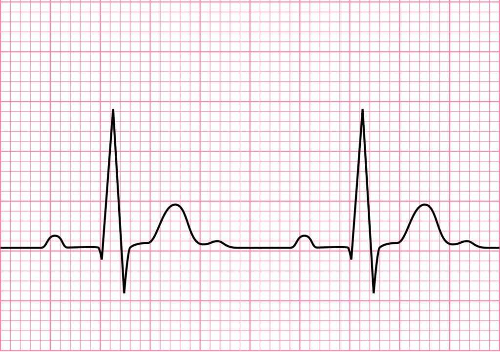 Исследования сердца, артериального давления: экг, холтер-экг, эхо-кг, смад