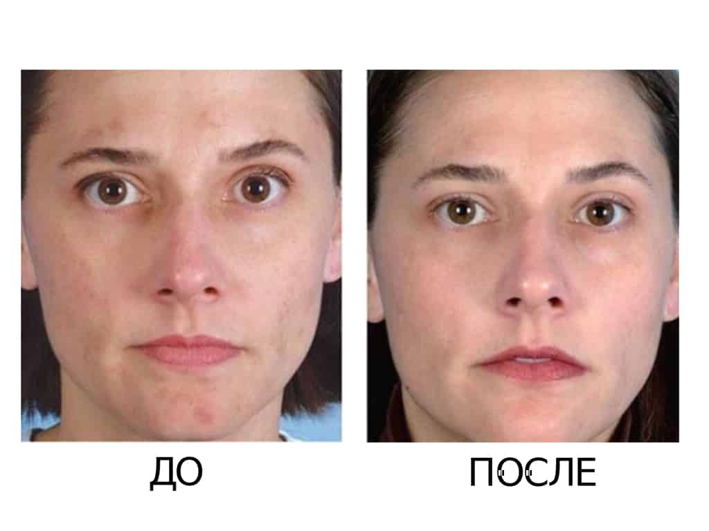 Уход за кожей лица: три шага