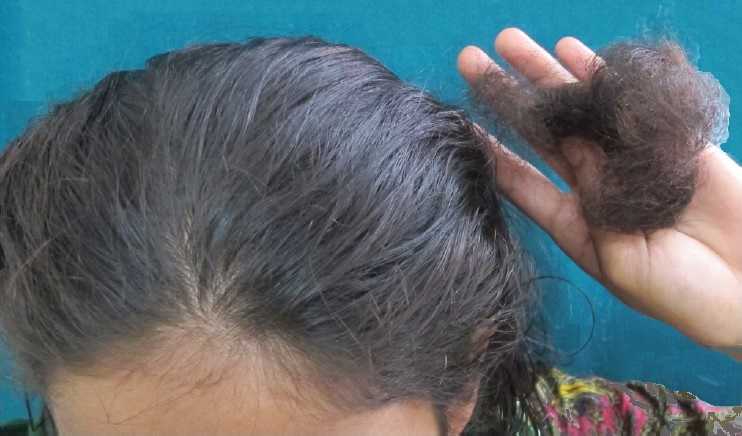 Может ли хороший шампунь от выпадения волос действительно спасти ваши волосы?