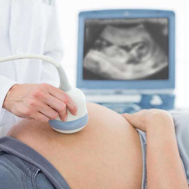Допплерометрия при беременности: что это такое, зачем и как проводят, результаты