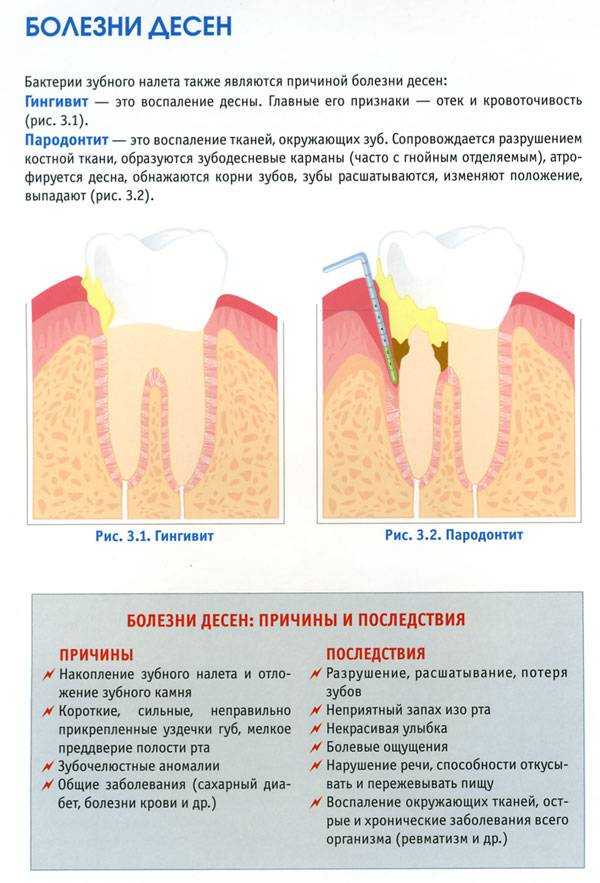 Определение болезней органов по зубам — один из научно доказанных способов диагностики