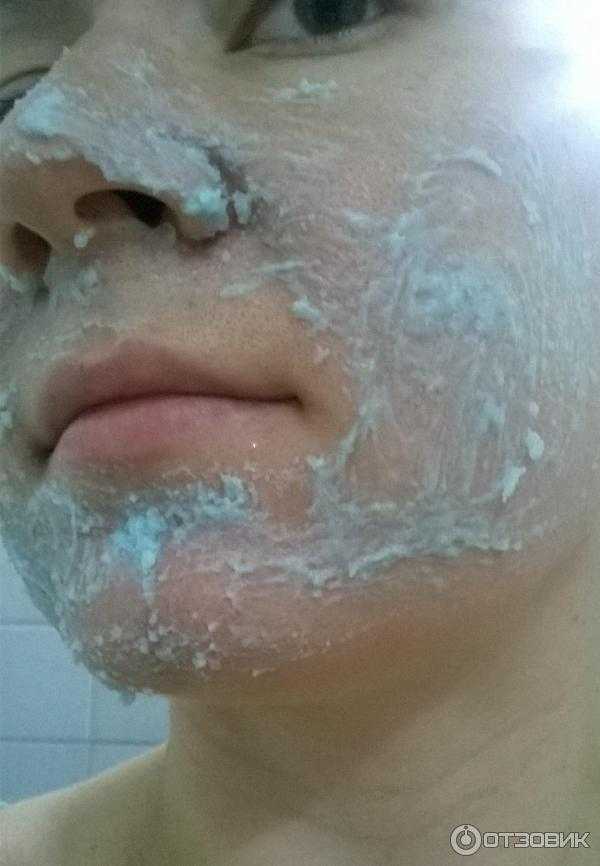 Лицо после механической чистки, противопоказания к ультразвоковой чисте комбинированной кожи лица
