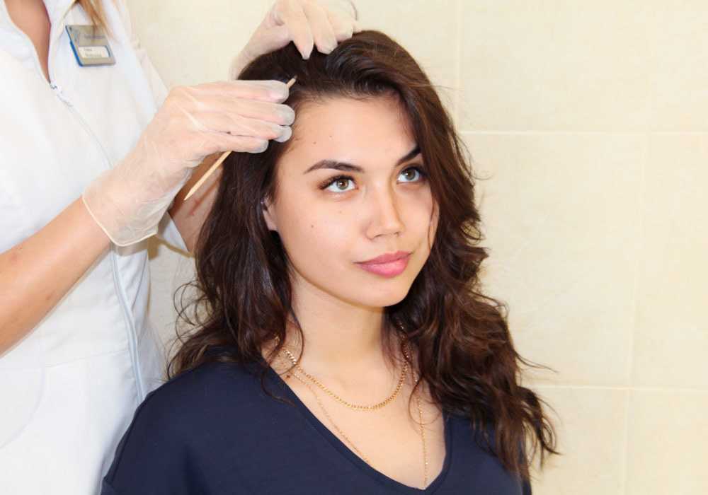 Волосы после коронавируса — выпадение волос после COVID-19, сильно лезут волосы у женщин, почему выпадают, что делать, лечение волос, отзывы, советы трихолога
