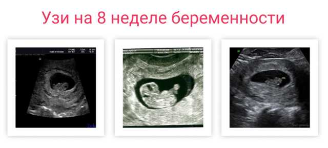 Менструальный цикл и зачатие