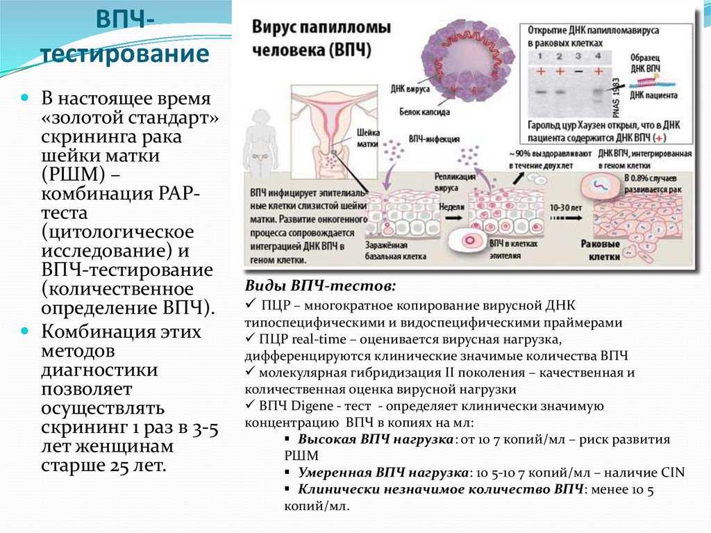 Вирус папилломы человека - признаки, причины, симптомы и лечение