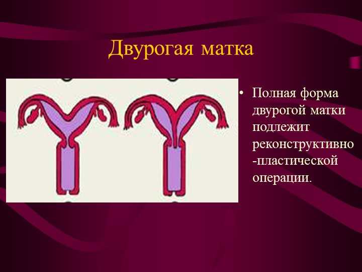 Медикаментозный аборт у пациенток с рубцом на матке
 - vmc verte medical clinic