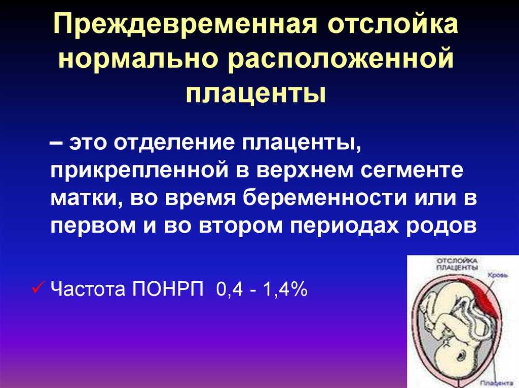Преждевременная отслойка плаценты - что делать и как определить — клиника isida киев, украина