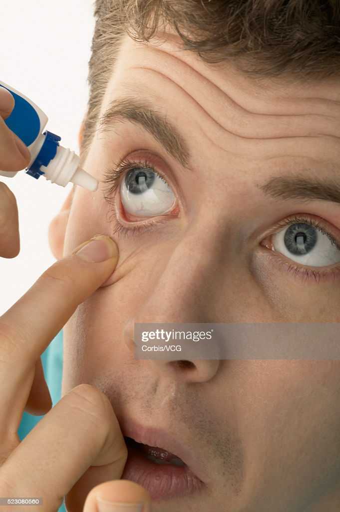 Аллергия вокруг глаз  - симптомы, причины, профилактика и лечение