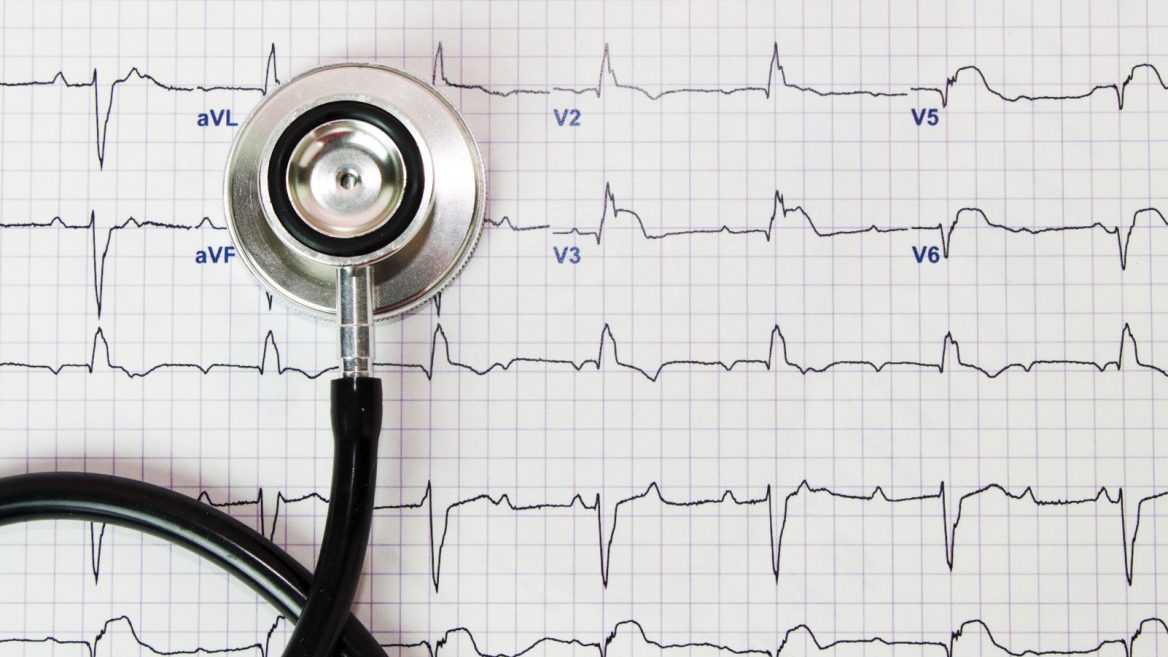 Экг – диагностика состояния сердца. показания к экг, что показывает исследование. как делают экг