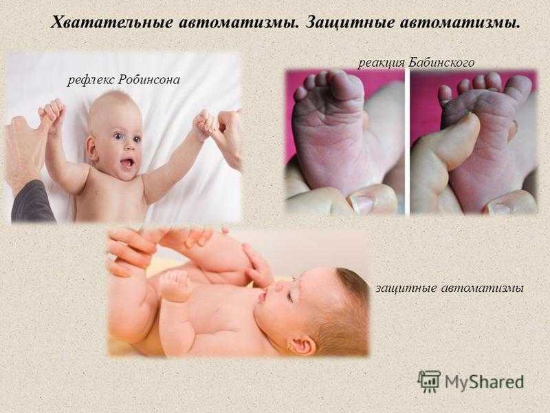 Врожденные какой рефлекс. Рефлексы новорожденных. Врожденные рефлексы новорожденных. Защитный рефлекс у новорожденных. Безусловные рефлексы новорожденных.