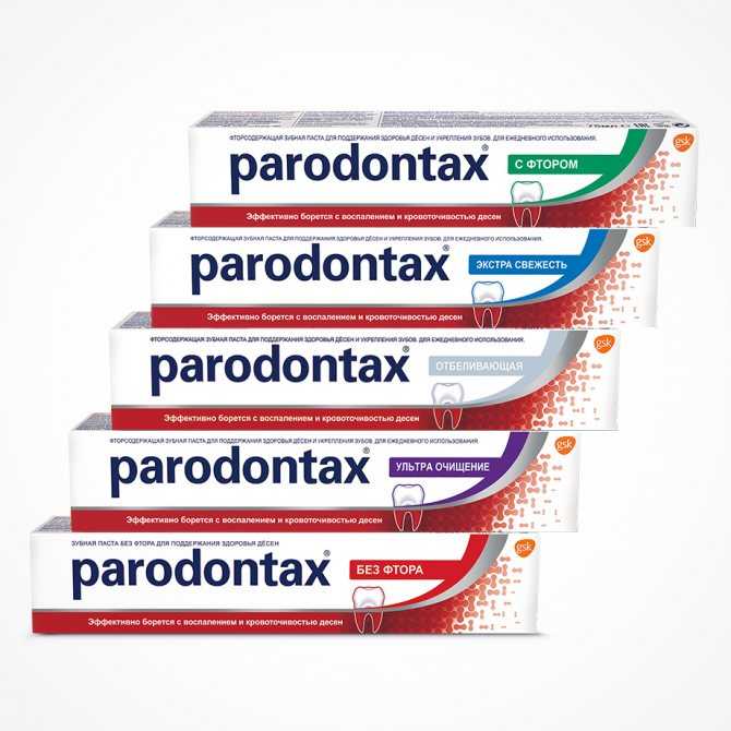 Причины заболеваний пародонта - гингивита, пародонтита и пародонтоза