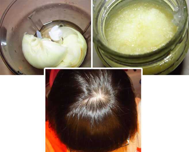 Маски для волос из лука в домашних условиях: 4 жгучих рецепта