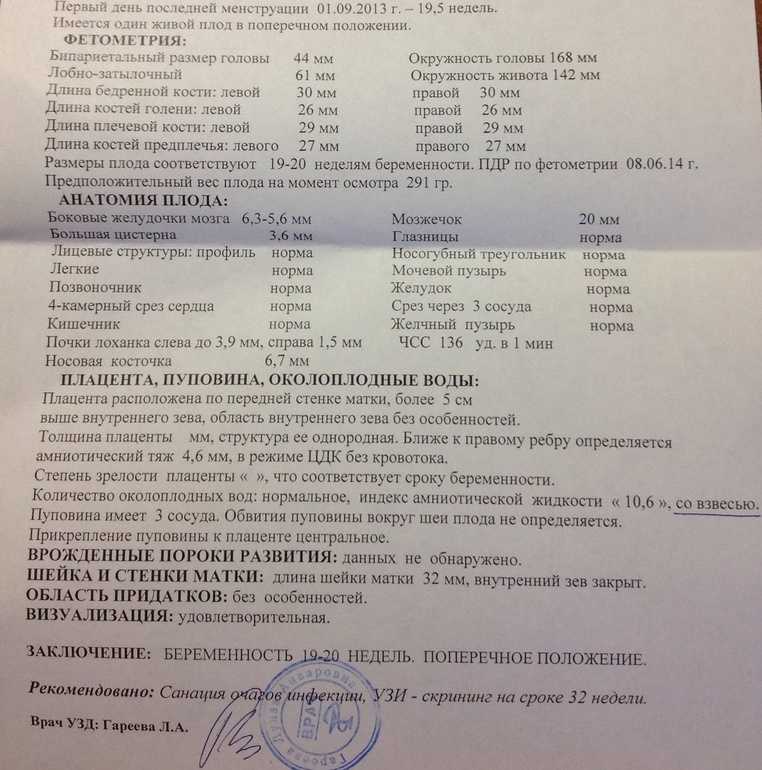 Пренатальный скрининг 2 триместра — сроки проведения, нормы, расшифровка, цены | клиника «линия жизни» в москве