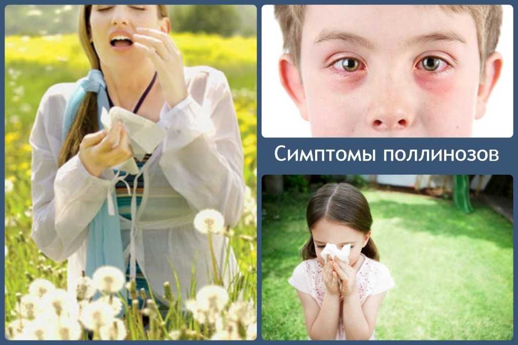 Календарь цветения для аллергиков: меры безопасности в сезон поллиноза