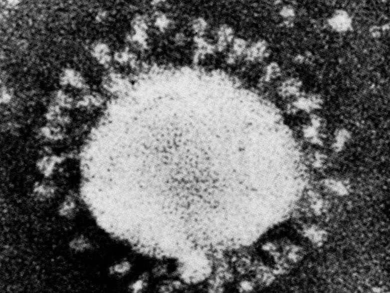Индийский штамм коронавируса: симптомы индийского ковида у взрослых