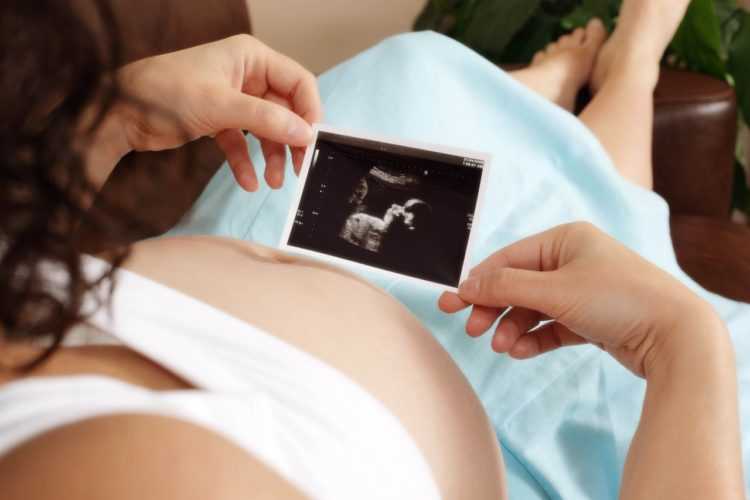 Беременность – пренатальный скрининг трисомий ii триместра беременности: исследования в лаборатории kdlmed
