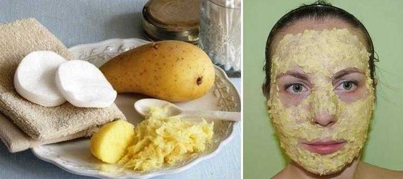 Маска из картофеля для лица: рецепты с сырой и вареной картошкой