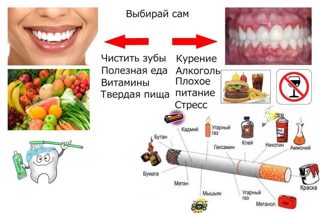 Разрушители зубов. главные враги зубной эмали