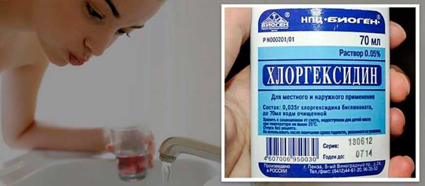 Хлоргексидин — лекарства — справочники — медицинский портал «мед-инфо»