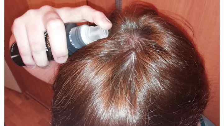Выпадение волос после коронавируса – волосы после ковида