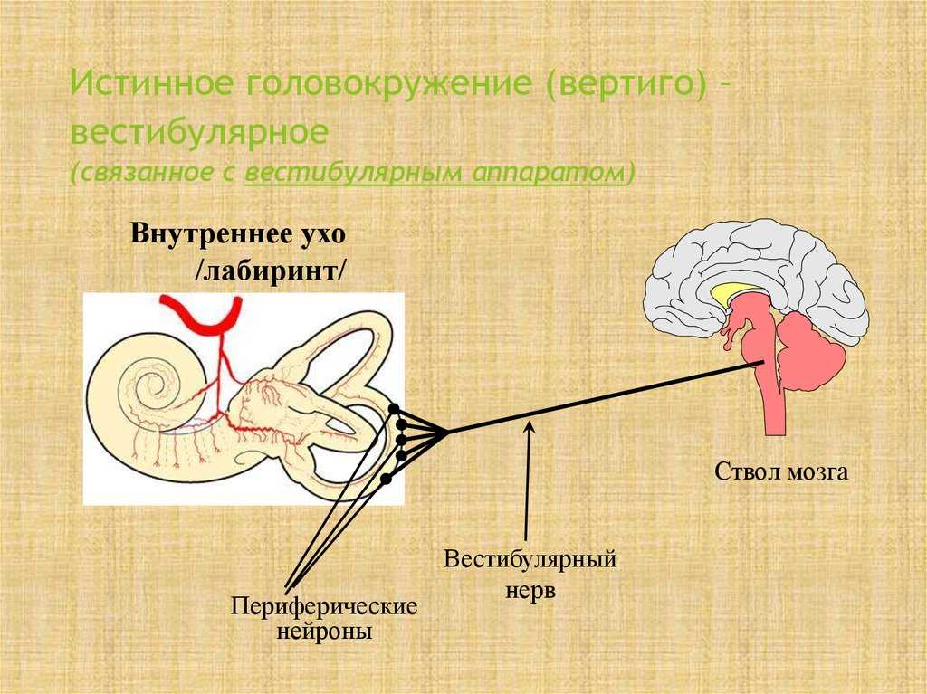 Вестибулярный аппарат мозг. Вестибулярный аппарат внутреннего уха. Вестибулярное головокружение. Истинное головокружение. Периферическое вестибулярное головокружение.