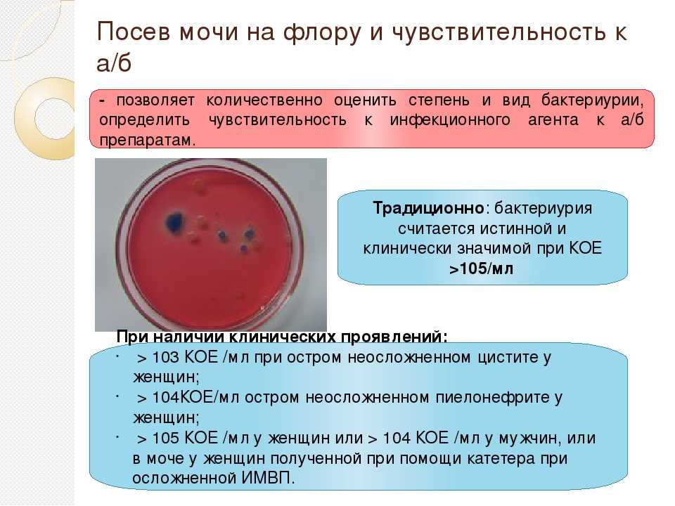 Бактериурия у беременных - что делать? клиника гравимед (оболонь, киев)