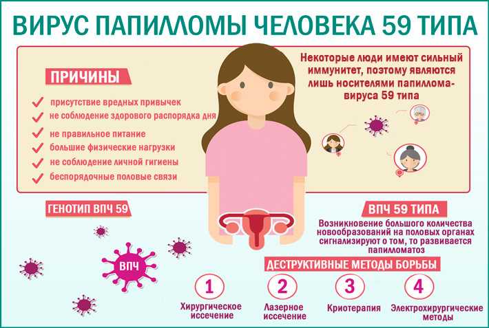 Впч и беременность - причины, симптомы, диагностика, лечение и профилактика
