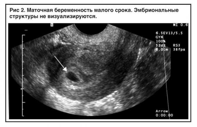 Медикаментозный аборт
 - vmc verte medical clinic