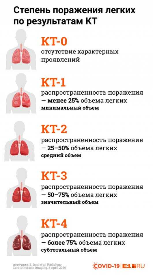 Степени поражения легких: кт1, кт2, кт3, кт4