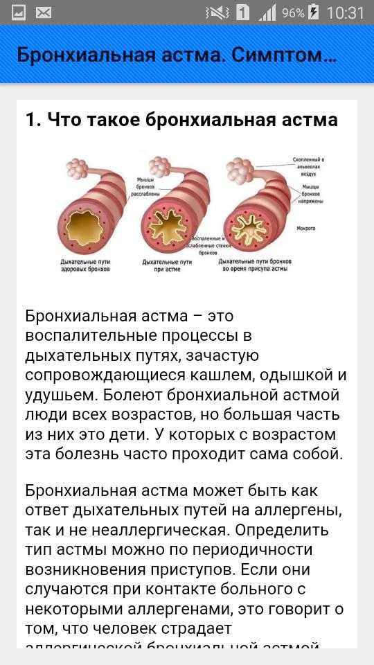 Бронхиальная астма | www.mgb1-74.ru