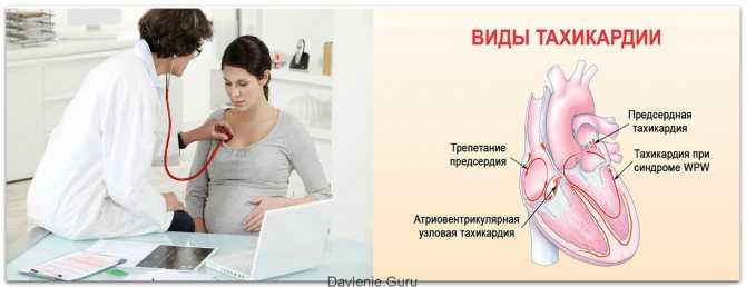 Гипертонус матки во время беременности - угрожающее состояние: сокращения мышц матки могут привести к выкидышу (на ранних сроках) или к преждевременным родам(в последние месяцы).