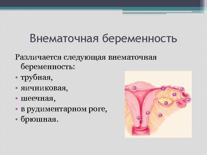 Внематочная беременность - симптомы и лечение