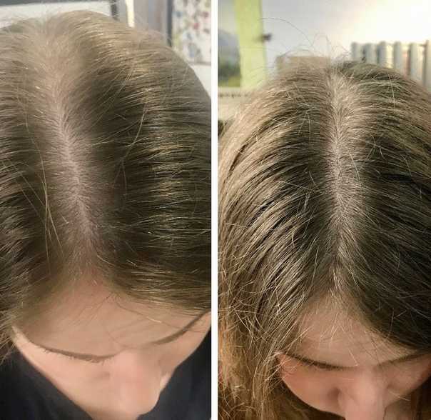 Топ-5 процедур для волос