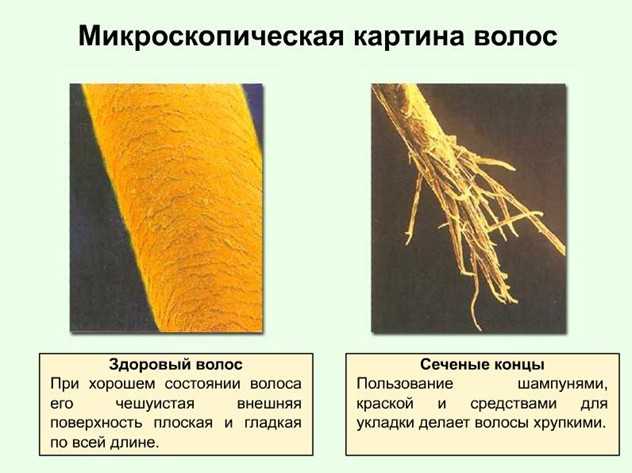Рост волоса происходит за счет деления. Поврежденная структура волос. Поврежденный волос под микроскопом. Структура здорового волоса. Обесцвеченный волос под микроскопом.