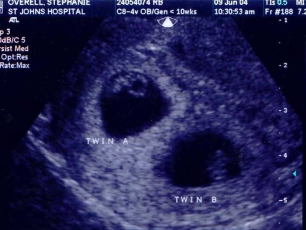 Тест на беременность – виды, когда делать, как делать? | аборт в спб
