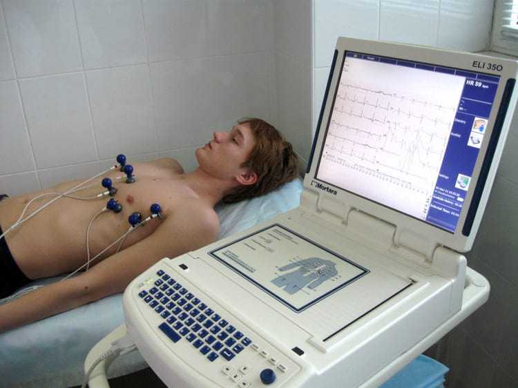 Электрокардиография
